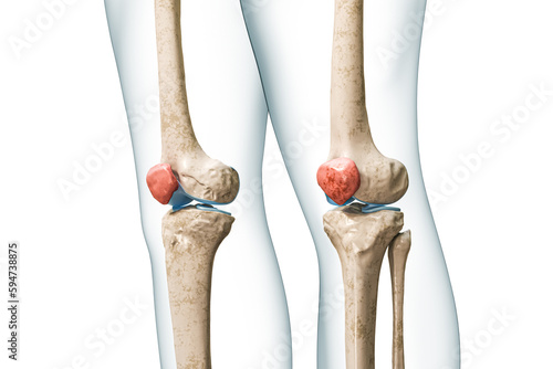 Photos Patella or kneecap bone in red color with body 3D rendering illustration isolated on white with copy space