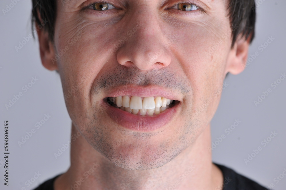 Fototapeta premium homem sorrindo mostrando os dentes 