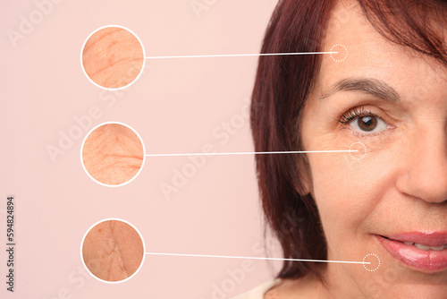 Beautiful mature woman on beige background, closeup. Zoomed skin areas showing wrinkles before rejuvenation procedures