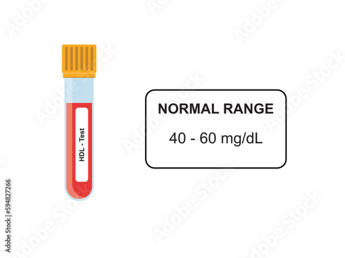 HDL Blood Test Concept Design. Vector Illustration.
