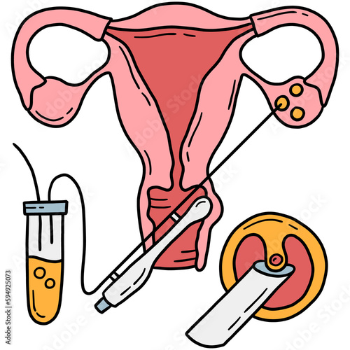 Canvas Print Egg retrieval and transvaginal oocyte extraction from ovaries, In Vitro fertiliz