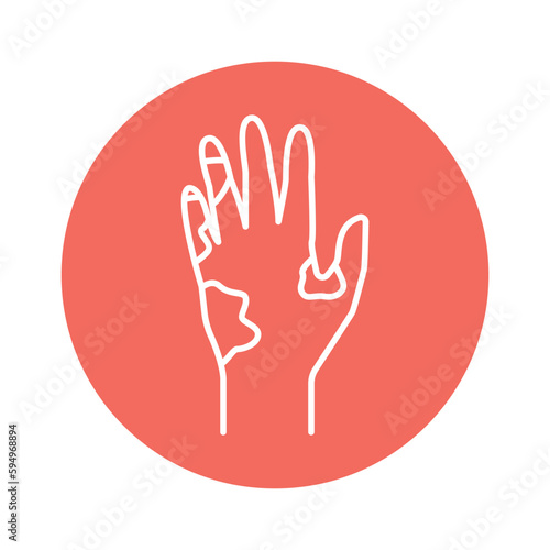 Scleroderma color line icon. Pictogram for web page