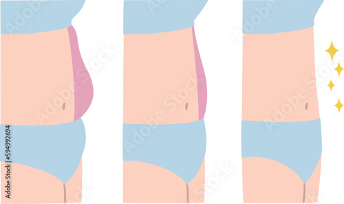 女性のお腹を比較したイラストセット