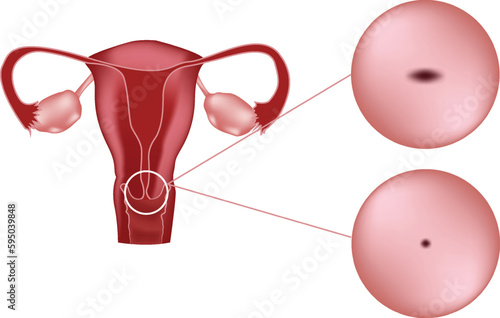 Structure of the female reproductive system, uterus, ovaries, cervix photo