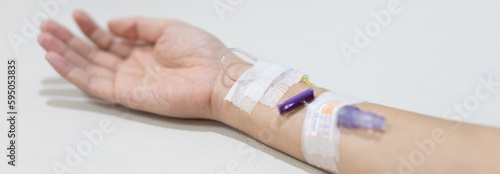 Arm puncture for intravenous infusion or medication for hospitalized patients, Treatment of patients with intravenous injections to allow the patient to receive the drug directly.