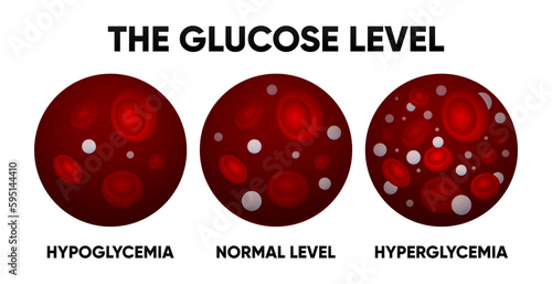 Glucose in the blood vessel. Normal levels, hyperglycemia, hypoglycemia. Normal, high and low blood sugar. Blood diagram. Vector illustration.