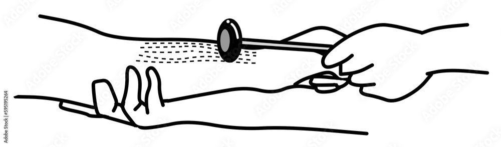 The physical examination of reflex. The physical examination of reflex.