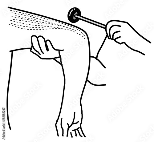 The physical examination of reflex.