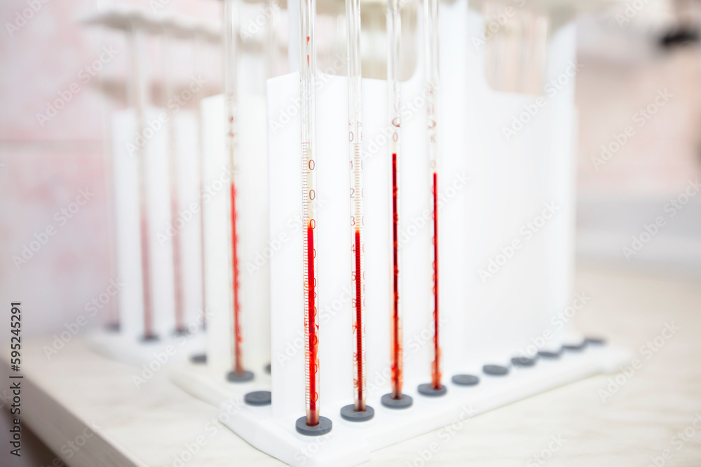 Test tubes with blood in a medical biochemical laboratory. Test tubes with blood in a medical biochemical laboratory.
