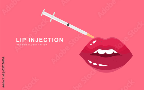 Lip injection. Cartoon red aesthetic beautiful lips, medical plastic cosmetology syringe with cosmetic injection, vector illustration concept of dermatology and cosmetology treatment.