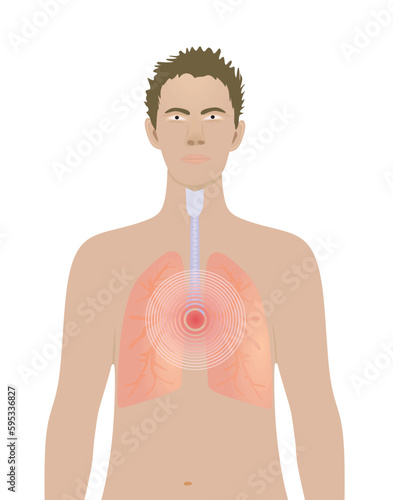 Lungs pain isolated on standing man. vector