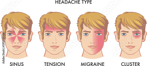 Ilustration of types of headache