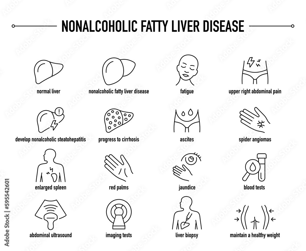 Nonalcoholic Fatty Liver Disease symptoms, diagnostic and treatment vector icon set. Line editable medical icons.