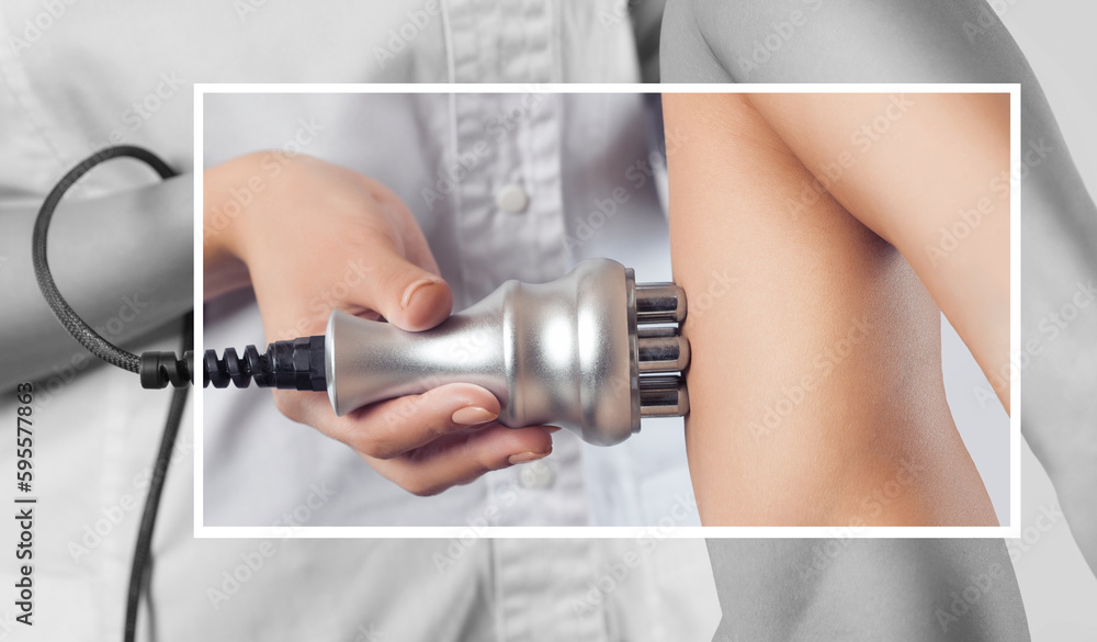 The doctor does the Rf lifting procedure on the upper arm of a woman in a beauty parlor. Treatment of overweight and flabby skin. The doctor does the Rf lifting procedure on the upper arm of a woman in a beauty parlor. Treatment of overweight and flabby skin.