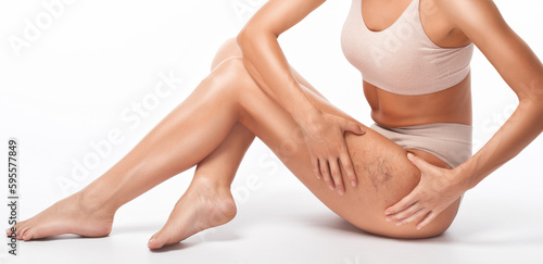 Beautiful slender woman sits on a couch in a spa salon. She shows varicose veins in the lower legs.Treatment of varicose veins and capillaries.