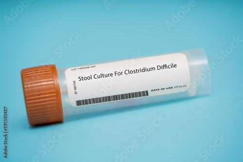Stool Culture For Clostridium Difficile photo