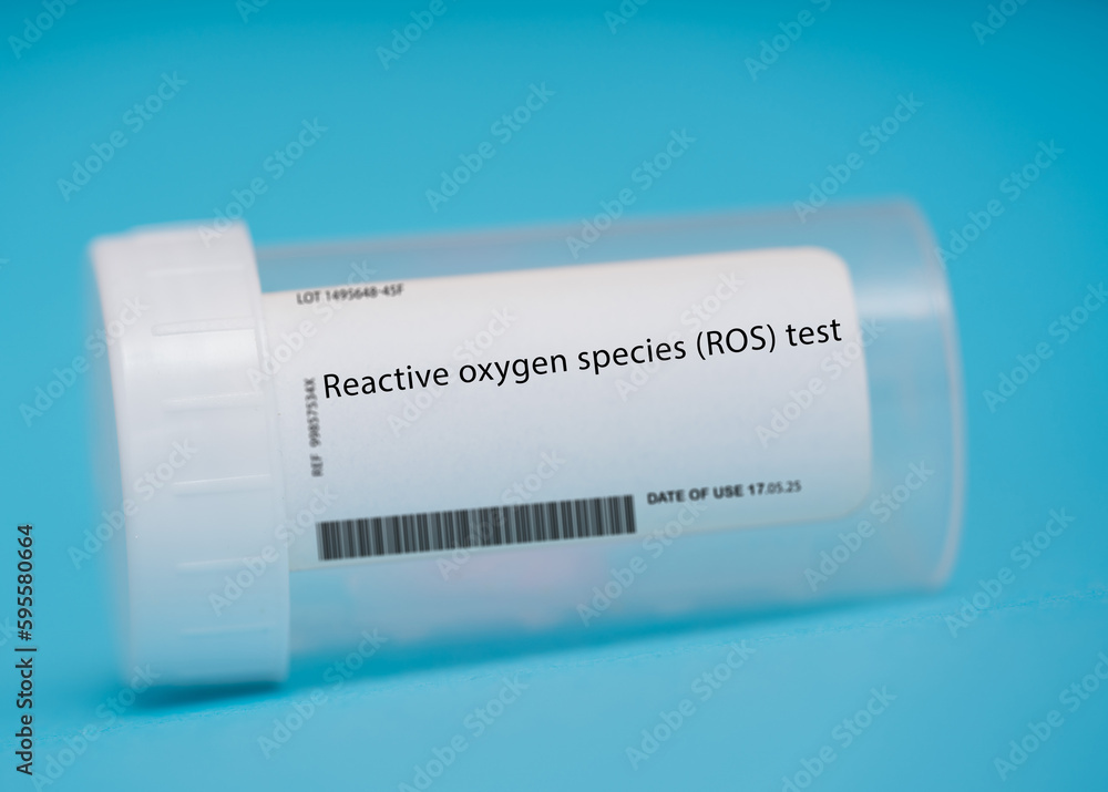 Reactive oxygen species (ROS) test Reactive oxygen species (ROS) test