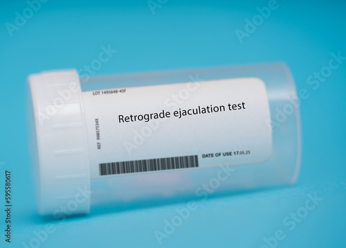 фотографія Retrograde ejaculation test