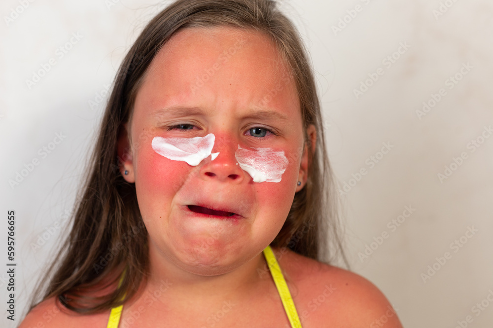 Crying school aged girl suffer from burns on face after spending time
