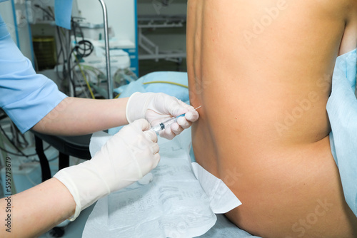 Injection of spinal anesthesia in preparation for surgery. The hands of an anesthesiologist in sterile gloves make an injection into the patient's spine. Spinal nerve block