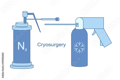 Cryo instruments for Cryosurgery vector line illustration. Liquid nitrogen cooling for cryogenic treatment. Ice therapy for benign and malignant lesions.