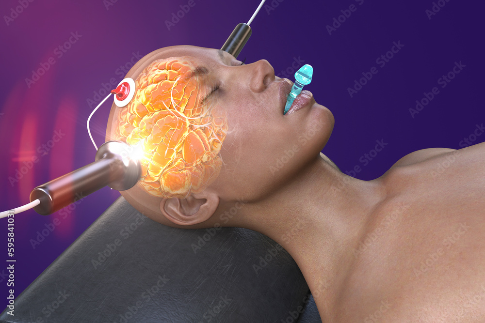 ECT Therapy Near Me Find the Right Support Today