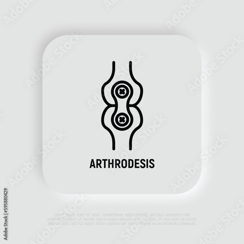 Arthrodesis joint surgery thin line icon. Arthritis. Vector illustration.