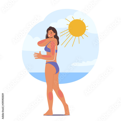 Woman Experience Skin Sunburn On Beach Due To Excessive Sun Exposure. Skin of Female Character Appears Red And Irritated