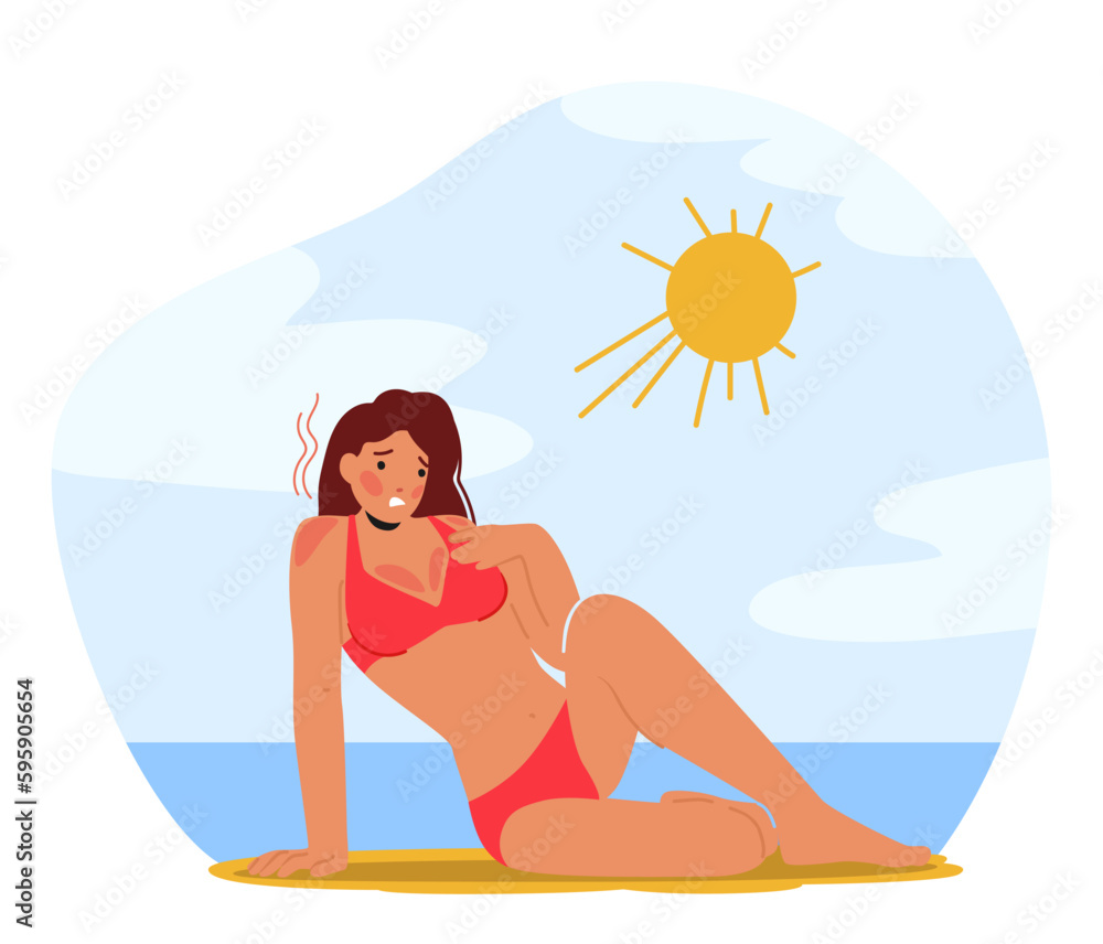 Woman In Pain With Skin Sunburn On Beach, Female Character With Red And Irritated Skin With Blisters And Discomfort