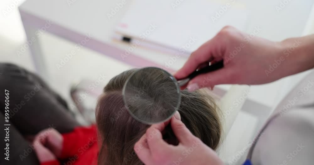 Doctor trichologist holds magnifying glass checking children hair. Difference between lice and nits from dandruff Doctor trichologist holds magnifying glass checking children hair. Difference between lice and nits from dandruff