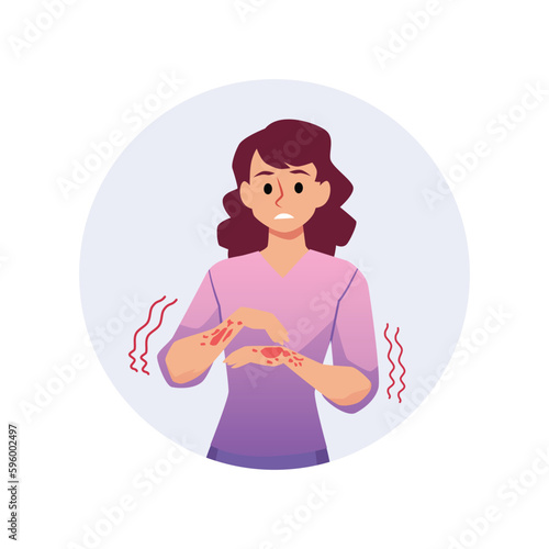 Woman with itchy red spots on hands, round frame flat style
