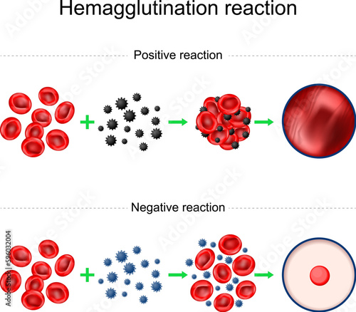 Hemagglutination reaction. Blood typing.