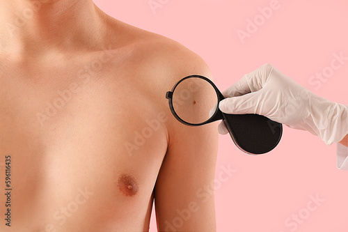 Dermatologist examining mole on young man's shoulder with magnifier against pink background, closeup