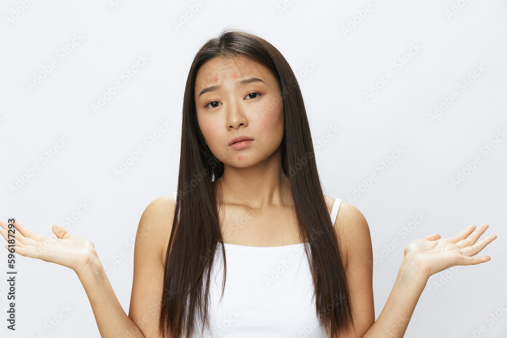 Asian woman facial skin problems, acne and inflammation, red rashes and allergies, chicken pox, sadness from rashes. Facial skin care concept for diseases and nerves Asian woman facial skin problems, acne and inflammation, red rashes and allergies, chicken pox, sadness from rashes. Facial skin care concept for diseases and nerves