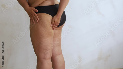 Back view of unrecognizable buxom woman wearing black underwear, squeezing skin of hip, buttock with hands, showing cellulite on white background. Skin care, body care, lymphatic drainage, obesity. 