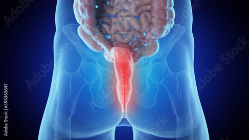Foto 3d medical illustration of a man's rectum