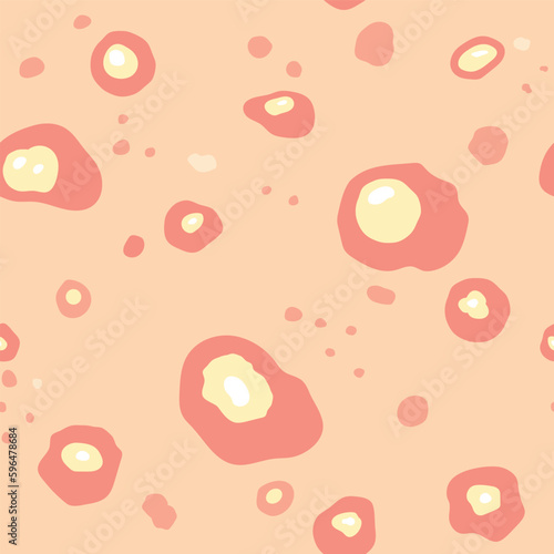 seamless pattern of skin with infected with acne, pimples- vector illustration