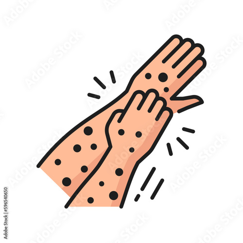 Allergy itching symptom color line icon. Seasonal, clothing material or food allergy reaction or allergen intolerance outline vector pictogram. Allergic symptom minimal icon or symbol with itchy hands