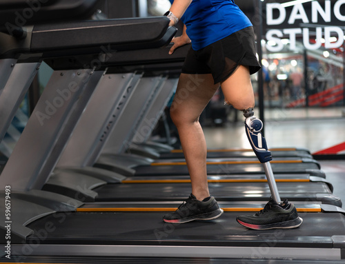 Low angle view at disabled woman with prosthetic leg walking in treadmill at fitness gym