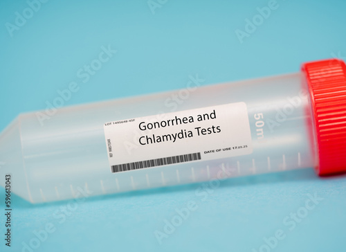Gonorrhea and Chlamydia Tests