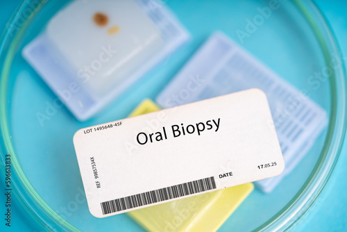 Oral Biopsy