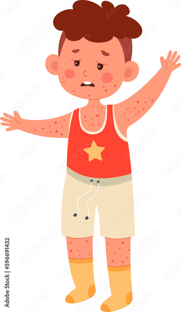 Boy With Chickenpox