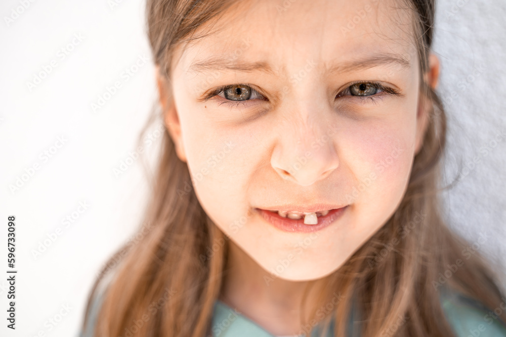 Charming smiling little girl kid with opened mouth shows staggering loose falling out first baby milk front tooth. Preschooler teeth changing. Healthy dental hygiene. Lost tooth. Dentist treatment Charming smiling little girl kid with opened mouth shows staggering loose falling out first baby milk front tooth. Preschooler teeth changing. Healthy dental hygiene. Lost tooth. Dentist treatment