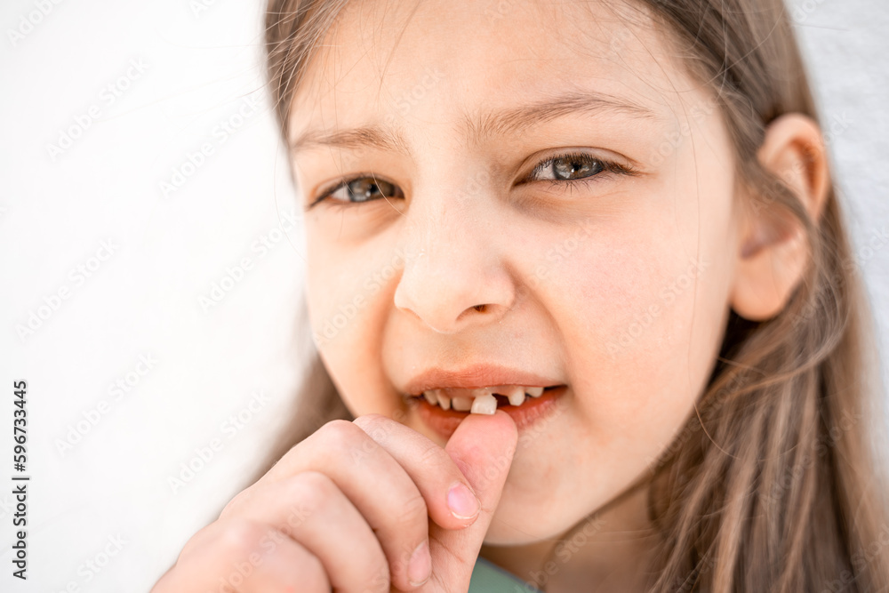 Charming smiling little girl kid with opened mouth shows staggering loose falling out first baby milk front tooth. Preschooler teeth changing. Healthy dental hygiene. Lost tooth. Dentist treatment Charming smiling little girl kid with opened mouth shows staggering loose falling out first baby milk front tooth. Preschooler teeth changing. Healthy dental hygiene. Lost tooth. Dentist treatment