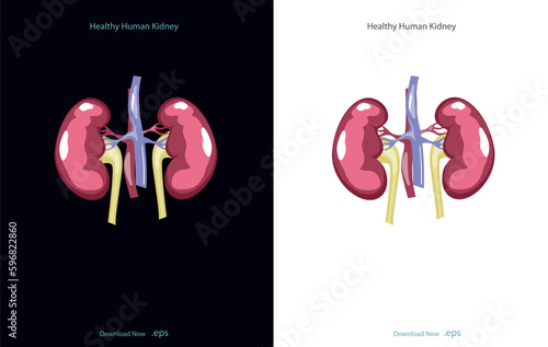 Chronic kidney disease, also called chronic kidney failure, involves a gradual loss of kidney function. Your kidneys can't filter wastes and excess fluids from your blood. Vector illustration.