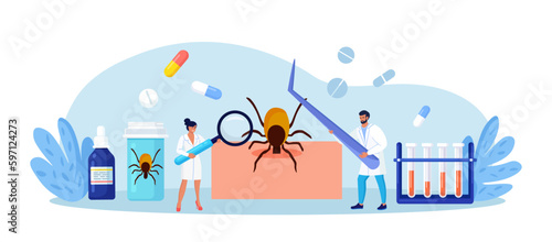 Prevention of Lyme, Encephalitis Diseases. Removing Encephalitis Ticks. Parasite Carrying Disease. First Aid with Infections Transmitted by Mites. Tick grabbed into skin, it is removed with tweezers
