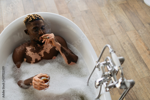 Top view of young african american man with vitiligo smoking cigar and holding glass of bourbon in bath with foam.