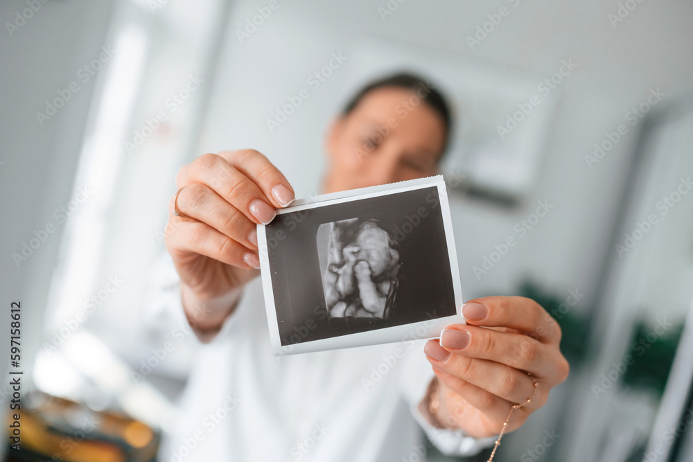 Standing and smiling. Woman in white coat is holding ultrasound picture of baby photo
