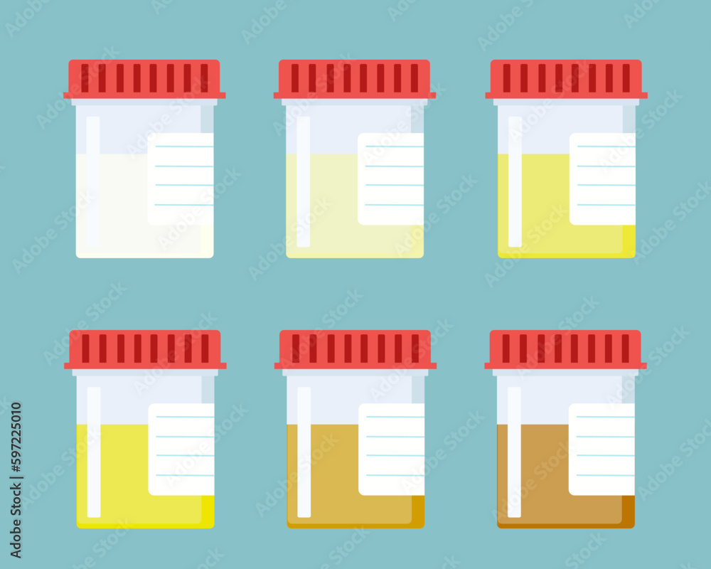 Urine color chart. Pee hydration and dehydration test strip. Urine in