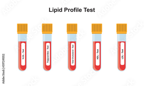 Lipid Profile Test Concept Design. Vector Illustration.